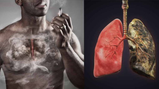Người hút thuốc ho ra đàm nâu có nguy hiểm không? - 1