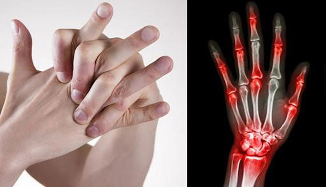 6 thói quen tàn phá xương khớp tưởng vô hại nhưng cực nguy hiểm - 1