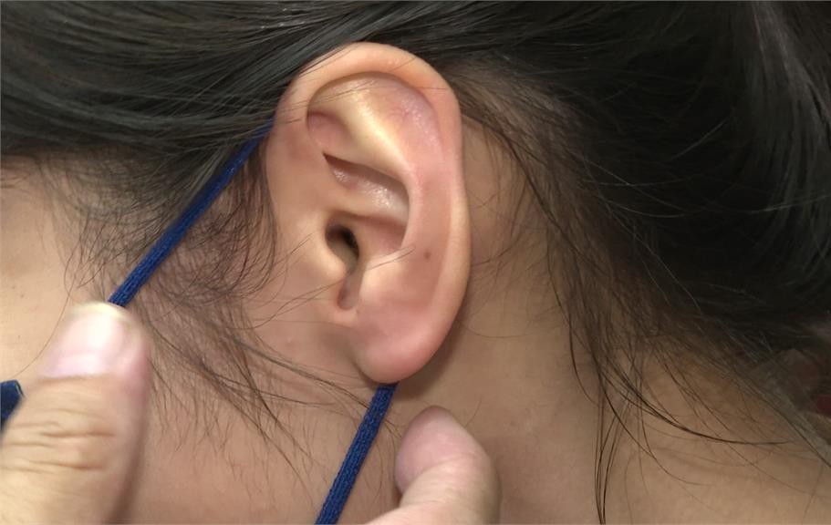 Tai có 4 thay đổi này có thể là dấu hiệu của viêm gan hoặc bệnh thận - 1