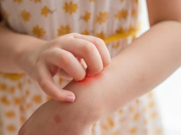 Xét nghiệm ký sinh trùng tại DIAG - Bảo vệ cơ thể khỏi nguy cơ tiềm ẩn từ bên trong  - 1