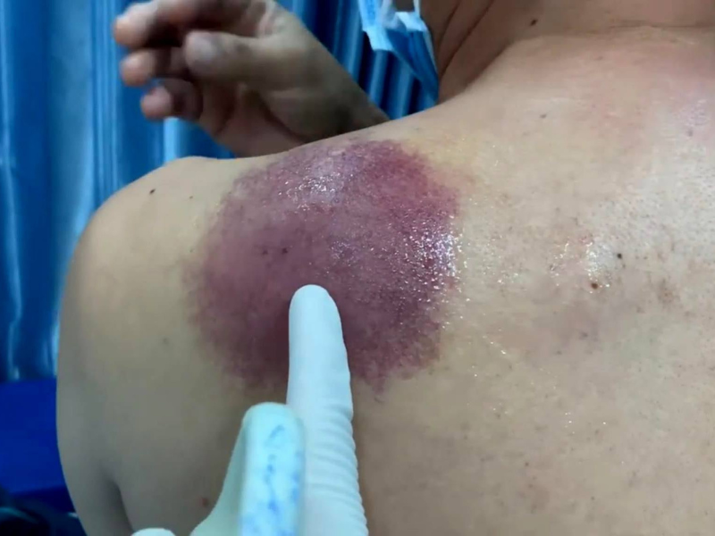 Bs Lê Lý Trọng Hưng: “Bàn tay vàng” trong chẩn đoán, can thiệp điều trị ung bướu - 2