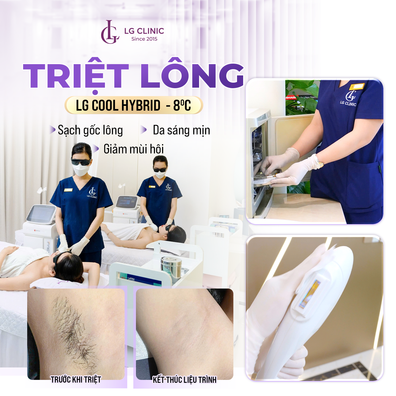 Công nghệ triệt lông LG Cool Hybrid –8°C giúp LG Clinic “vượt mặt” mọi đối thủ nhờ 3 điểm cộng vượt trội này - 2