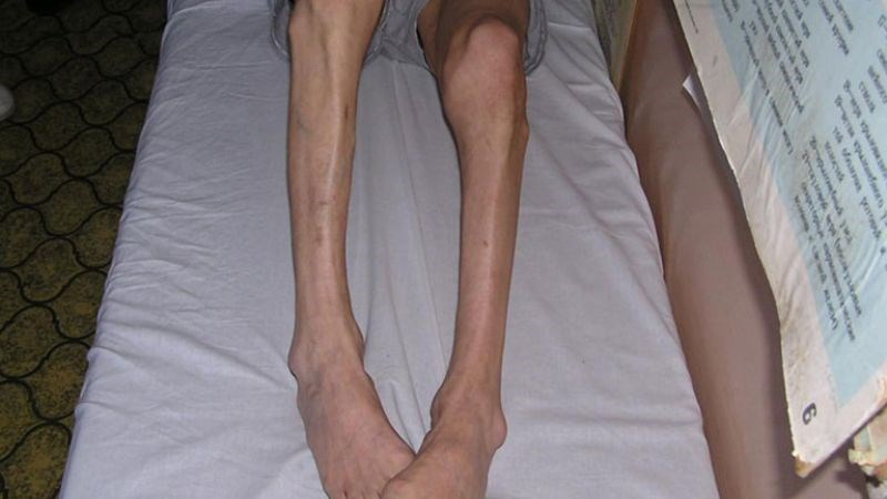 Không ngờ: Loại đạm đặc biệt trong Protein Bách Niên Kiện lại là ‘chìa khóa’ cho xương khớp dẻo dai - 1