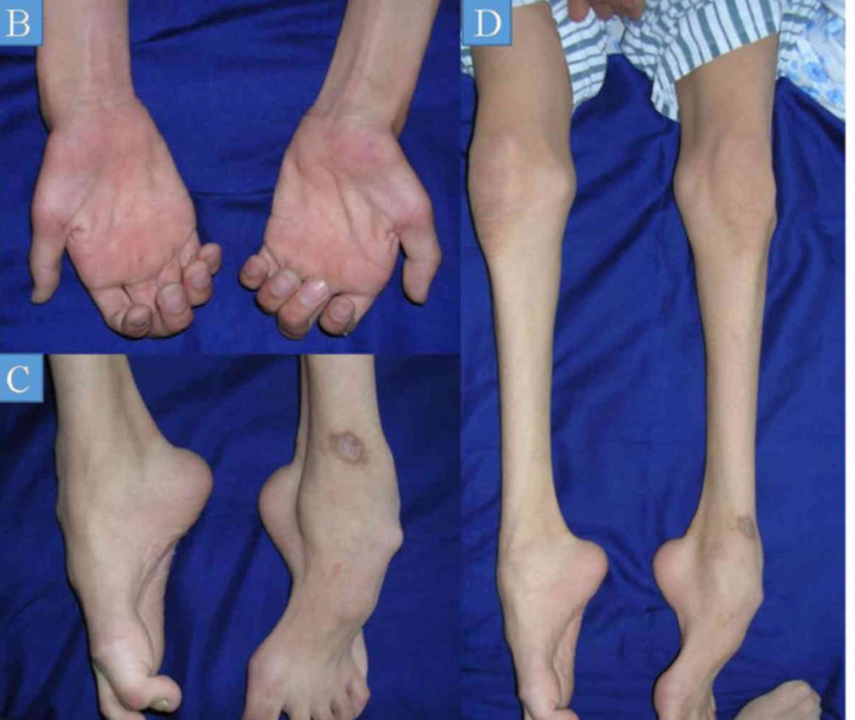 Đừng bỏ qua: 3 biểu hiện lạ ở người đau nhức xương khớp cảnh báo cơ thể đang suy kiệt - 1