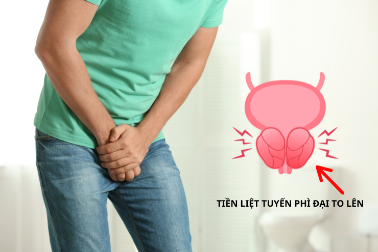 4 món ăn nhiều nam giới mê mẩn nhưng tuyến tiền liệt lại rất “sợ”! - 2