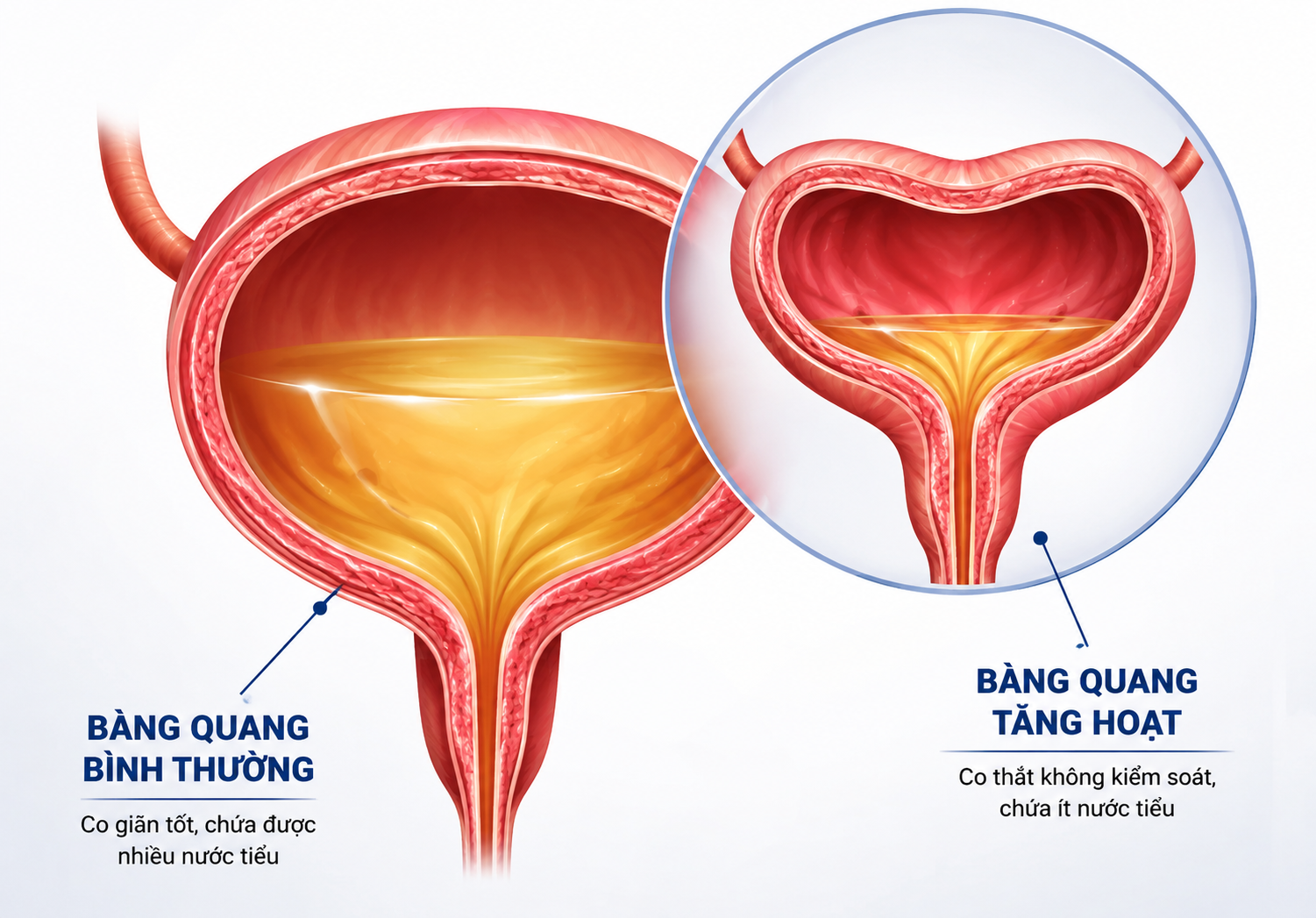 Chuyên gia tiết lộ “thủ phạm” ít ai ngờ tới sau những cơn buồn tiểu giữa đêm! - 1