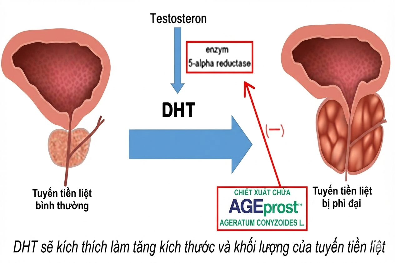 Chớ đợi đến khi tiểu đêm mới lo, thêm ngay 5 thực phẩm này vào bữa ăn hàng ngày để bảo vệ tuyến tiền liệt từ sớm - 2