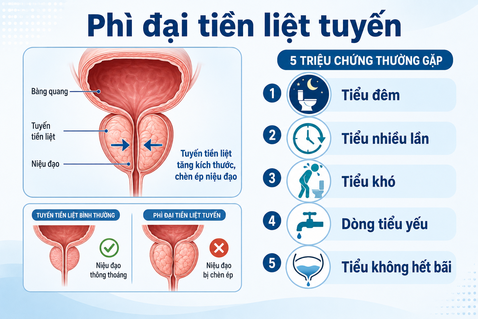4 nguyên nhân ít ai để ý khiến nam giới dễ bị phì đại tiền liệt tuyến sớm hơn - 3