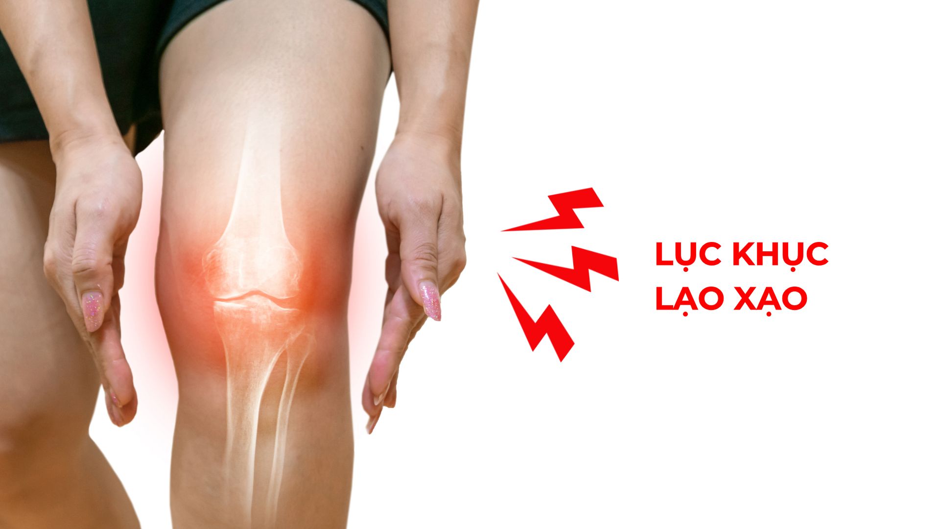 Dấu hiệu cảnh báo xương khớp đang bị tổn thương nghiêm trọng - 2