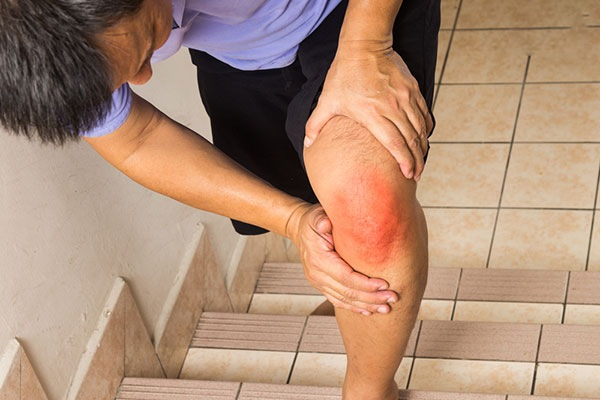 Dấu hiệu cảnh báo xương khớp đang bị tổn thương nghiêm trọng - 1