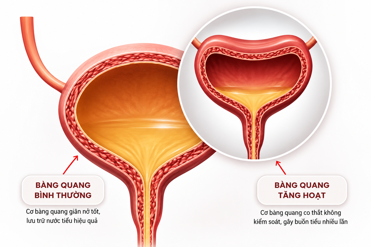 4 thói quen âm thầm "hủy hoại" bàng quang, khiến sức khỏe “lao dốc” vì tiểu đêm kéo dài! - 2
