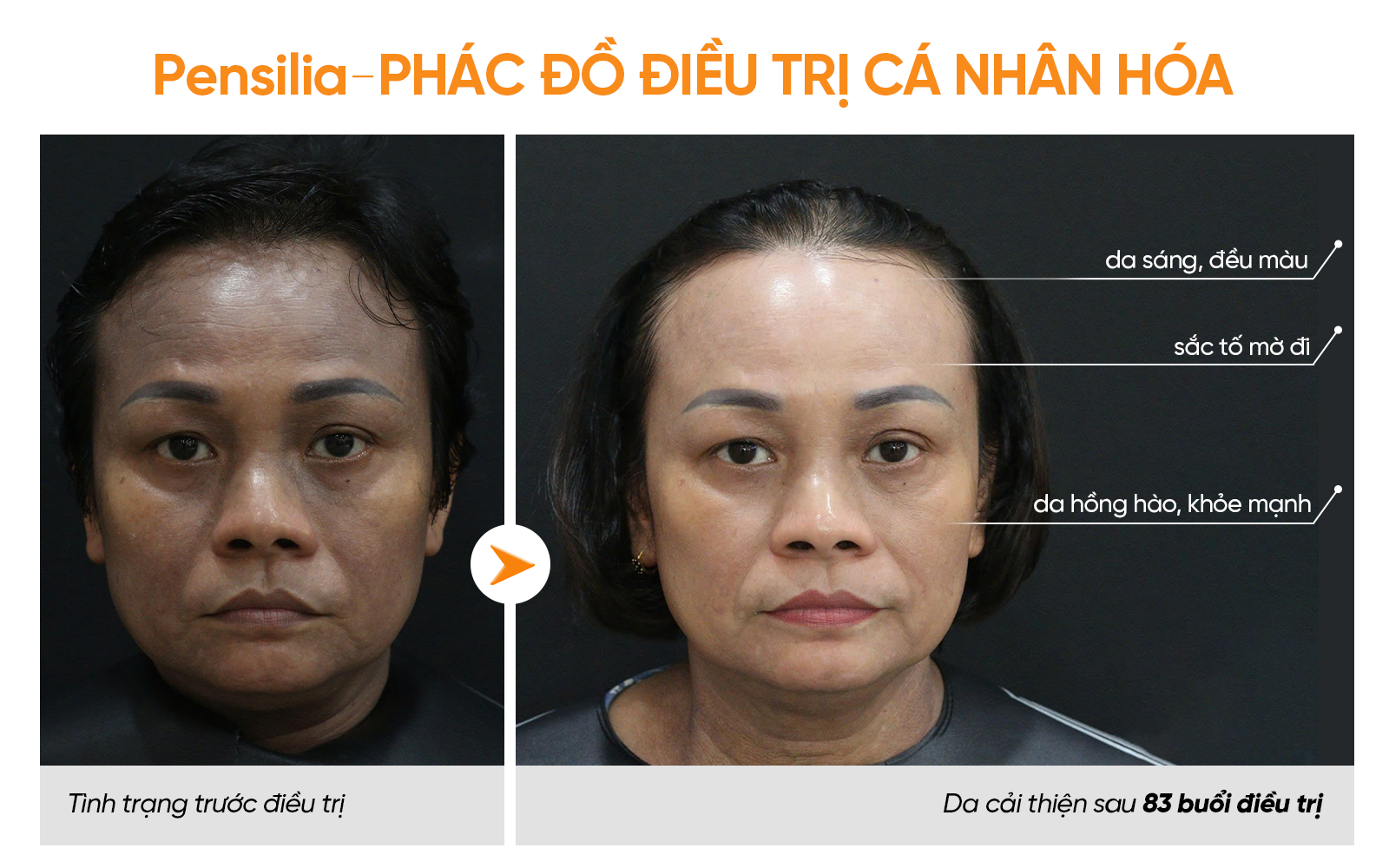 ThS. BS CKII Nguyễn Phương Thảo và hành trình 3 năm giải cứu ca nám nặng của nữ khách hàng TP.HCM - 3