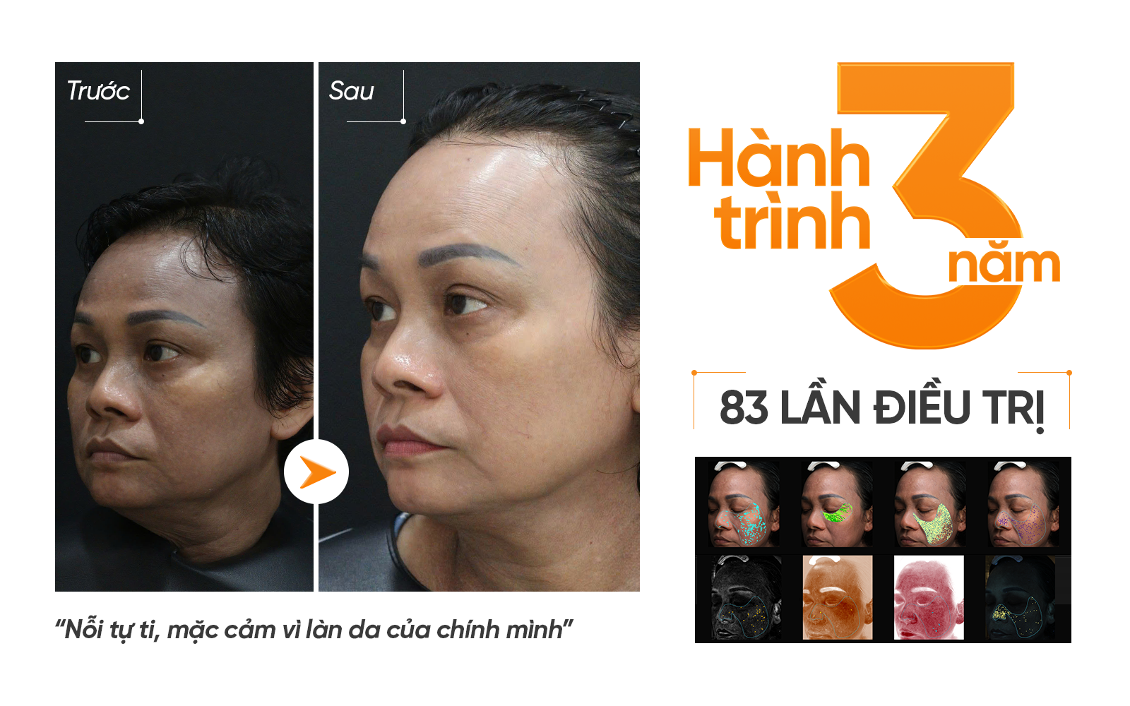 ThS. BS CKII Nguyễn Phương Thảo và hành trình 3 năm giải cứu ca nám nặng của nữ khách hàng TP.HCM - 1