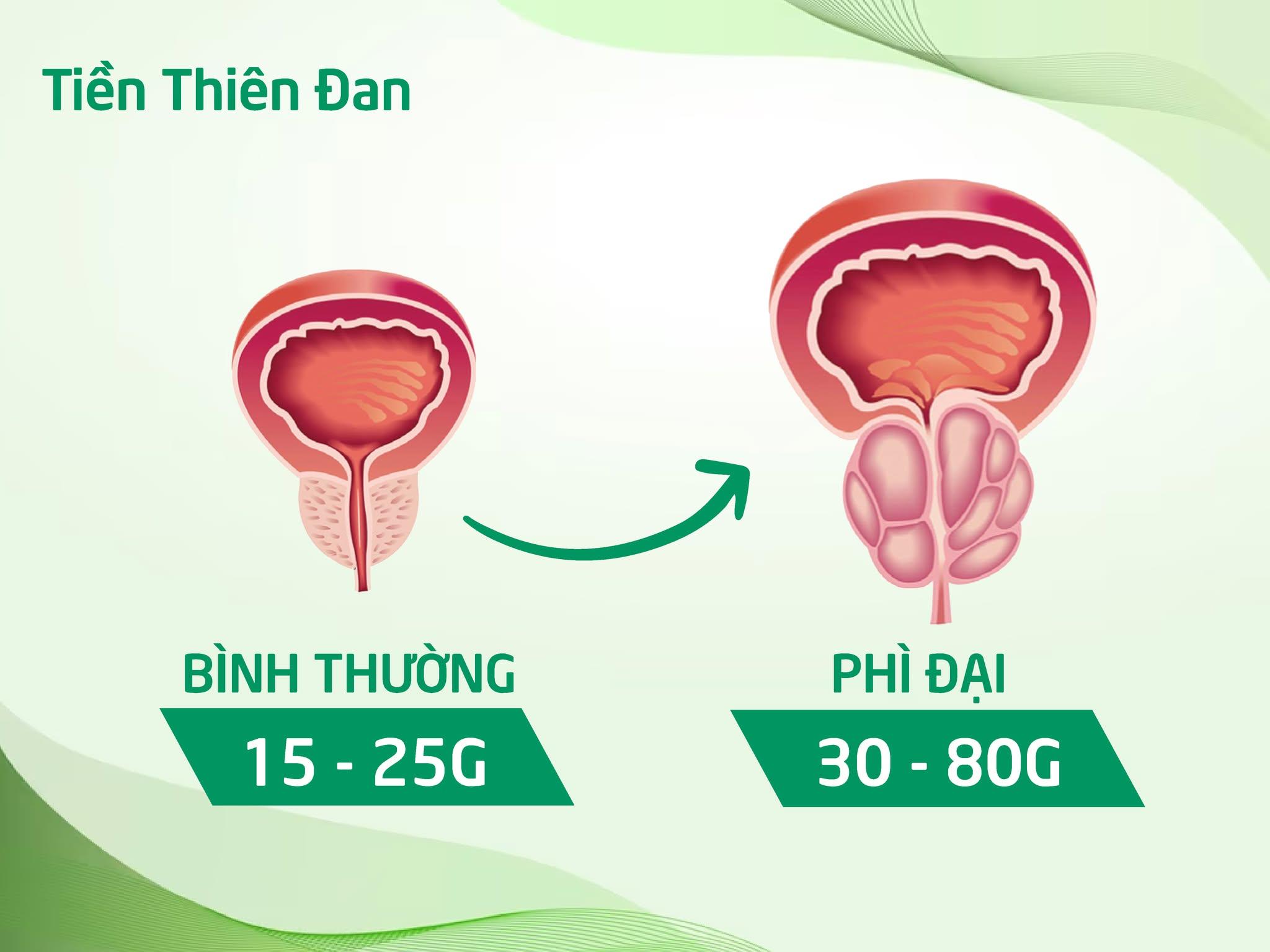 Loại rau dại trước chỉ để cho lợn ăn, nay thành “đặc sản”, giúp đường tiểu thông thoáng, đi giải êm ru! - 3