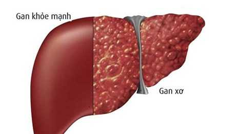 Phyllan Hoàng Hoa - bí quyết cải thiện chức năng gan an toàn, hiệu quả - 1