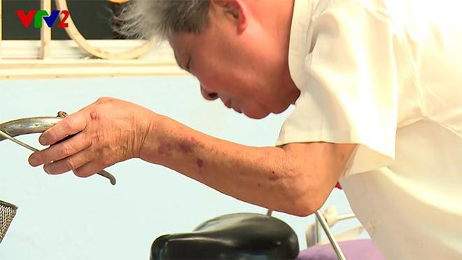 Giá như biết cách này sớm hơn, tôi đã không bị đau nhức xương khớp hành hạ suốt 13 năm - 2