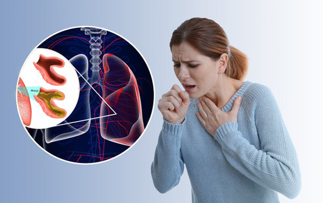 Không chỉ là “cơn ho của người hút thuốc”: 3 triệu chứng đờm, ho, khó thở có thể là bệnh hô hấp mạn tính nguy hiểm - 1