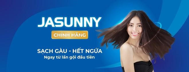 Da đầu có mảng trắng "ngứa điên đầu" là gàu mảng hay vảy nến? - 4