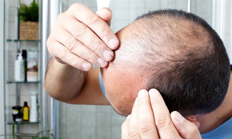 Có thể bạn chưa biết lý do khiến tóc khô xơ, cứng, gàu “trắng đầu” gội mãi không hết! - 1