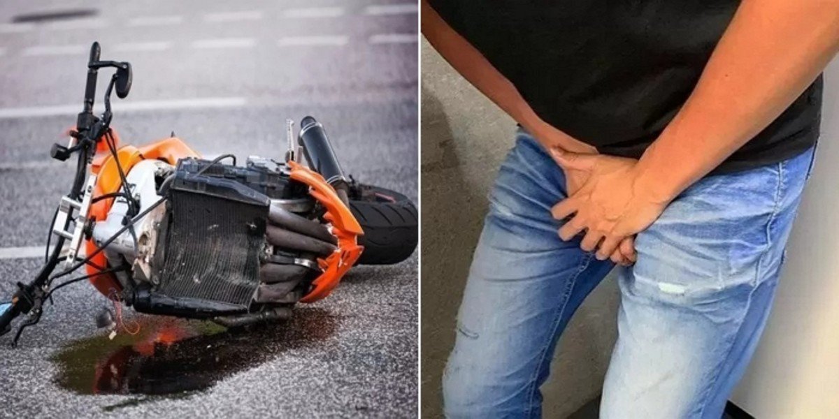 Bị ngã xe, tinh hoàn của chàng trai chui tọt lên bụng - 1