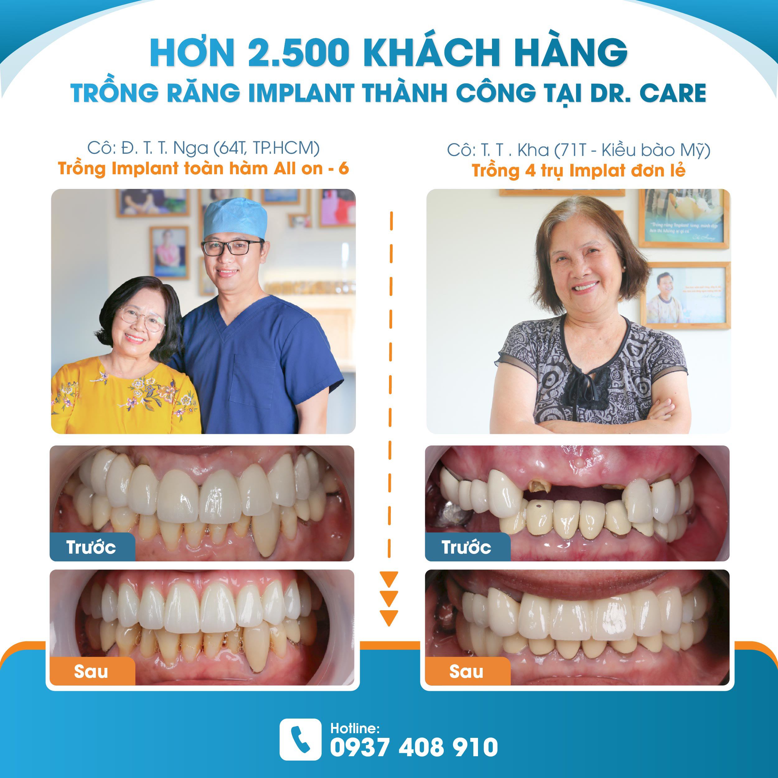 Dr. Care Implant Clinic - Địa chỉ trồng răng Implant uy tín tại TP.HCM - 5