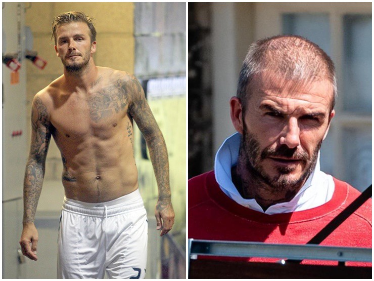 Beckham để lộ đầu hói nặng khó chữa làm nhiều người giật mình - 4