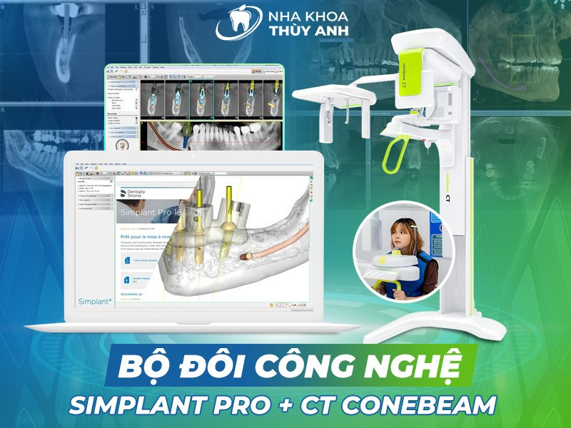 Nha khoa Thùy Anh - Trung tâm trồng răng implant uy tín tại Hà Nội - 4