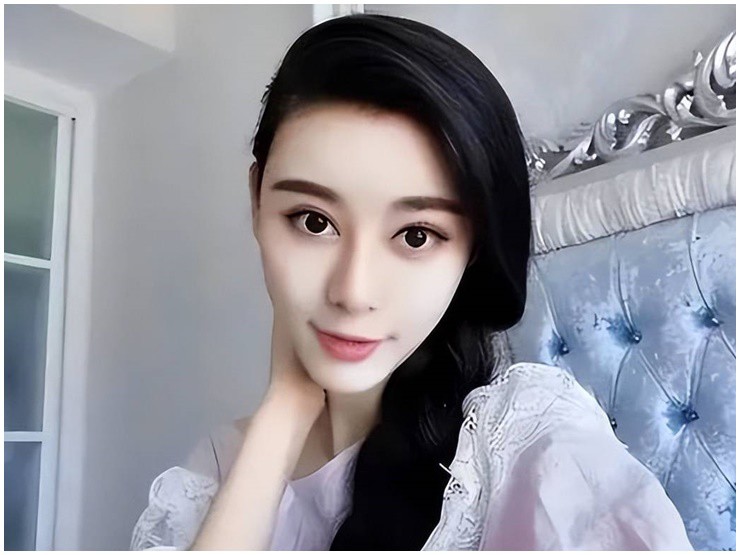 Bác sĩ lấy cô gái chi 27 tỷ đồng phẫu thuật giống Phạm Băng Băng rồi nhận kết đắng - 2
