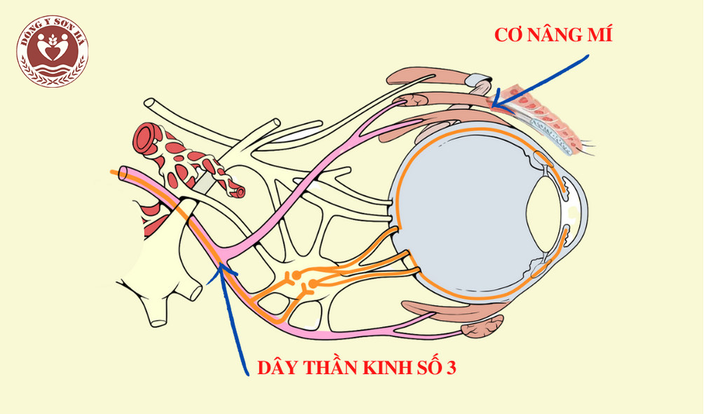 Tại sao liệt dây thần kinh số 3 gây sụp mí mắt? - 1