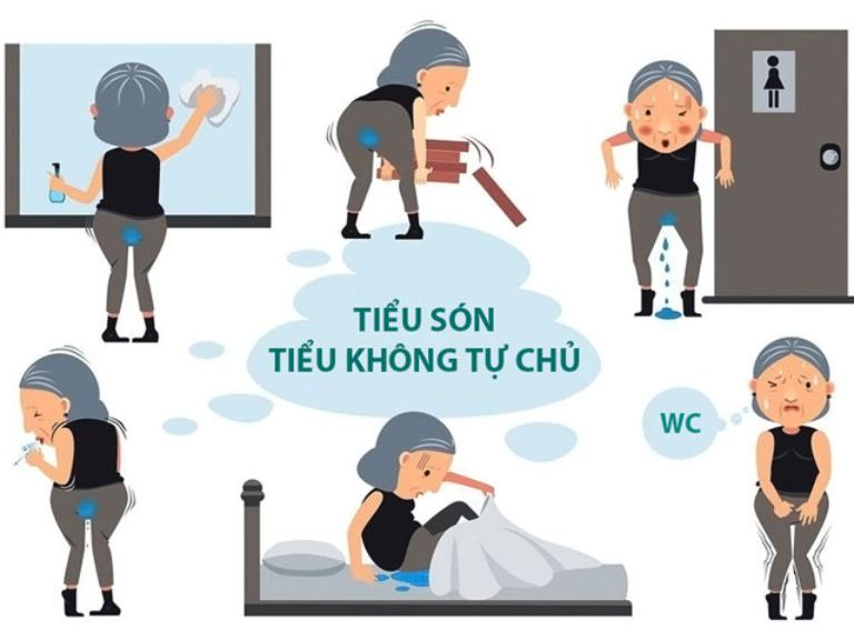 3 dấu hiệu cảnh báo bàng quang kêu cứu bạn không nên bỏ qua - 2