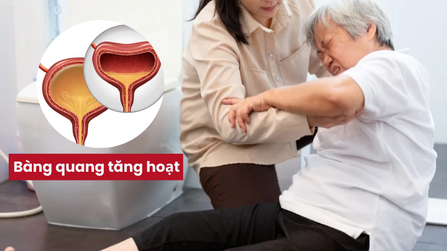 3 dấu hiệu cảnh báo bàng quang kêu cứu bạn không nên bỏ qua - 5