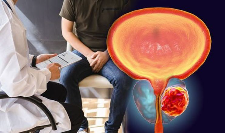 Giới khoa học tìm ra cách kìm hãm một trong những căn bệnh ung thư nguy hiểm nhất - 2