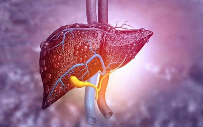 Những dấu hiệu ở tay cảnh báo gan đang "kêu cứu" - 2