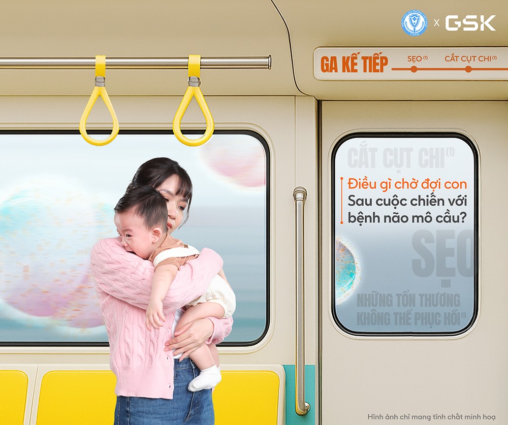 Bệnh não mô cầu - bố mẹ cần hiểu để lường trước - 1