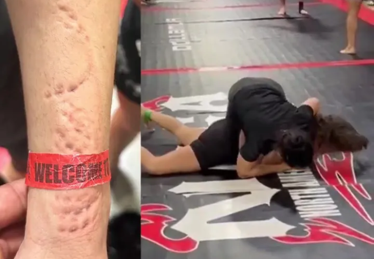 "Suarez nữ" khiến làng võ phẫn nộ, cắn đối thủ "không trượt phát nào" - 1