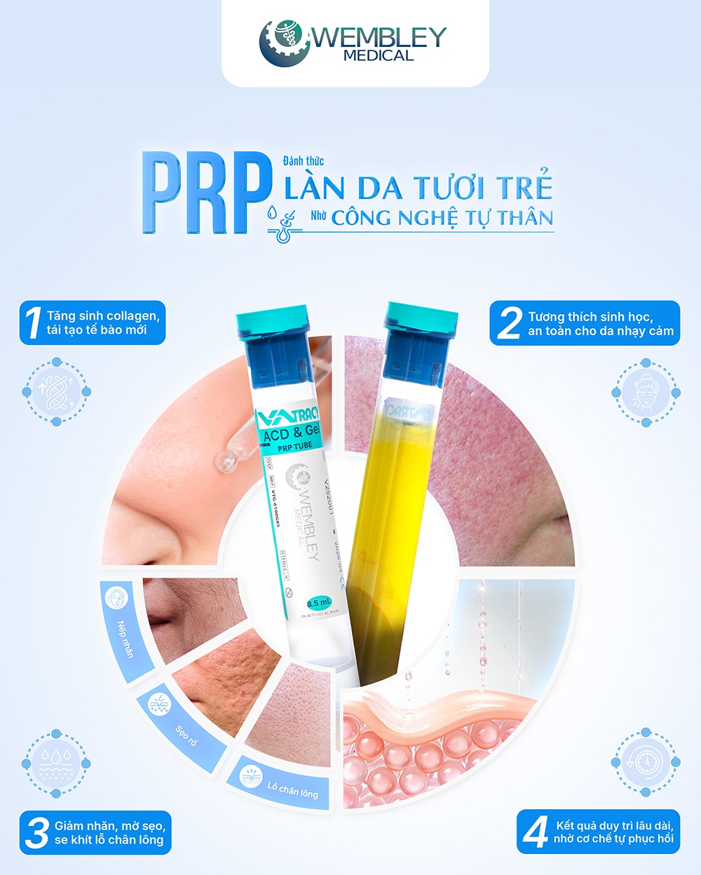 PRP - Công nghệ tự thân dẫn đầu xu hướng làm đẹp an toàn - 2