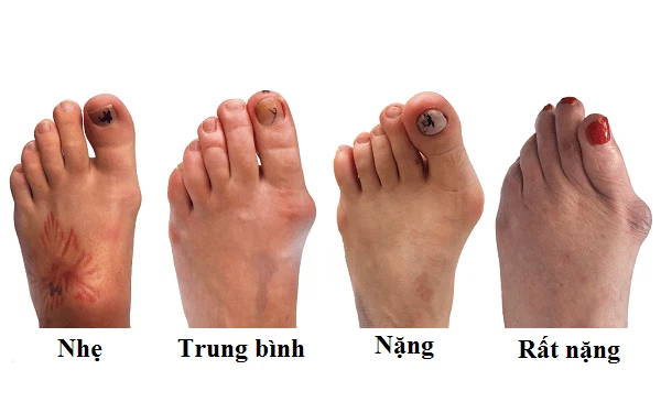 Thói quen ai cũng mắc phải khiến xương khớp “xuống cấp” không phanh - 1