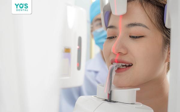 Yo's Dental: Nha khoa uy tín hơn 17 năm tại Thủ Dầu Một - 2
