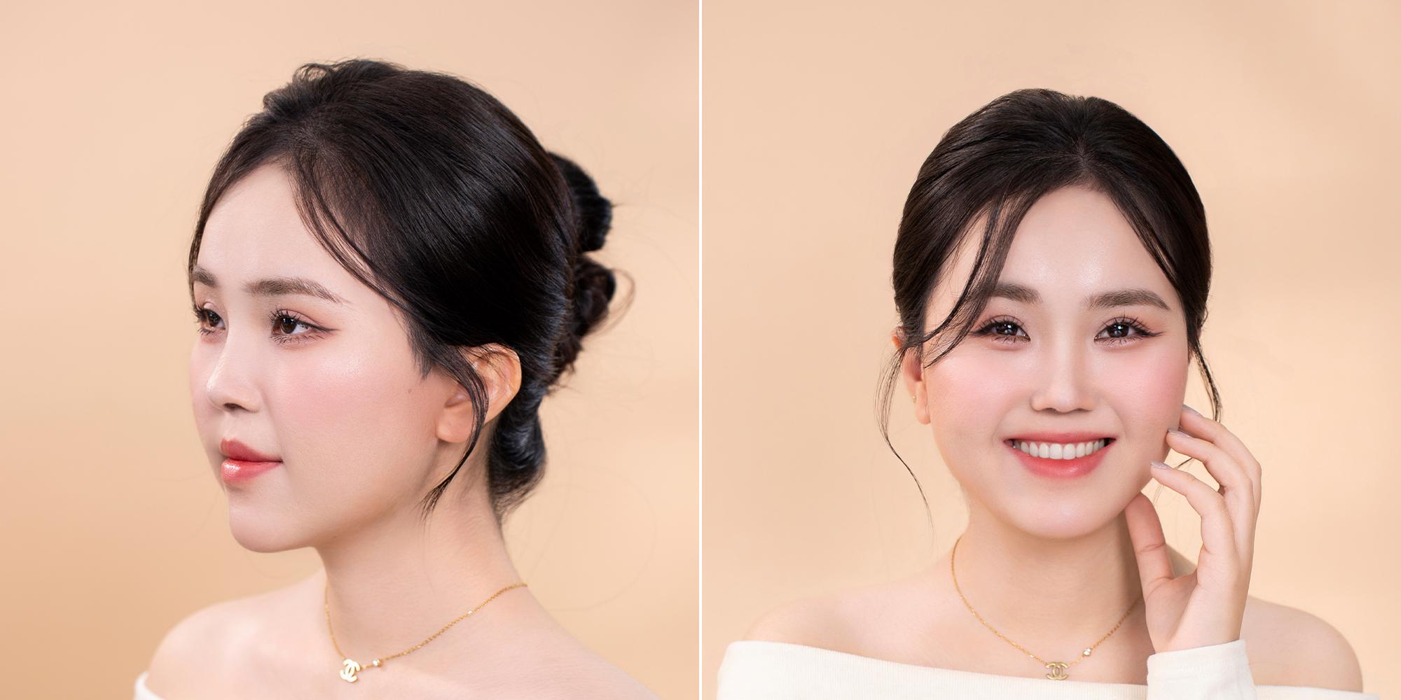 Tái sinh nhan sắc cho cô gái không có sống mũi - 3