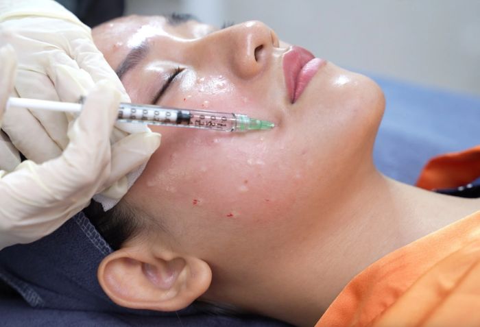 Những dịch vụ da liễu được quan tâm nhất năm 2025: Bạn nên chọn gì khi đến phòng khám? - 2