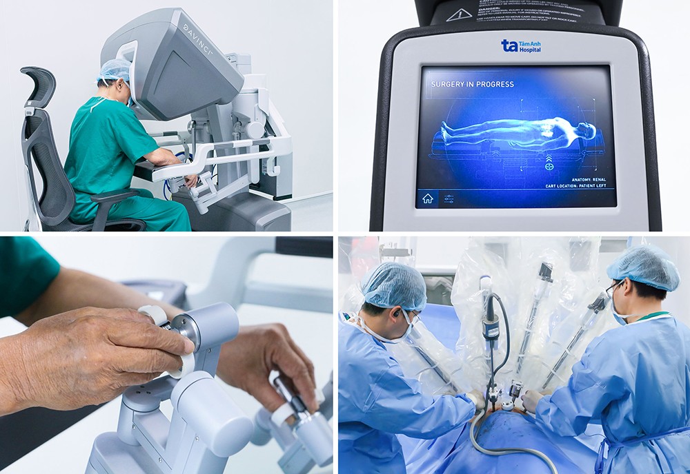 Robot phẫu thuật thế hệ mới cập bến Tâm Anh: Người bệnh tiết kiệm tới hàng tỷ đồng mỗi ca - 5