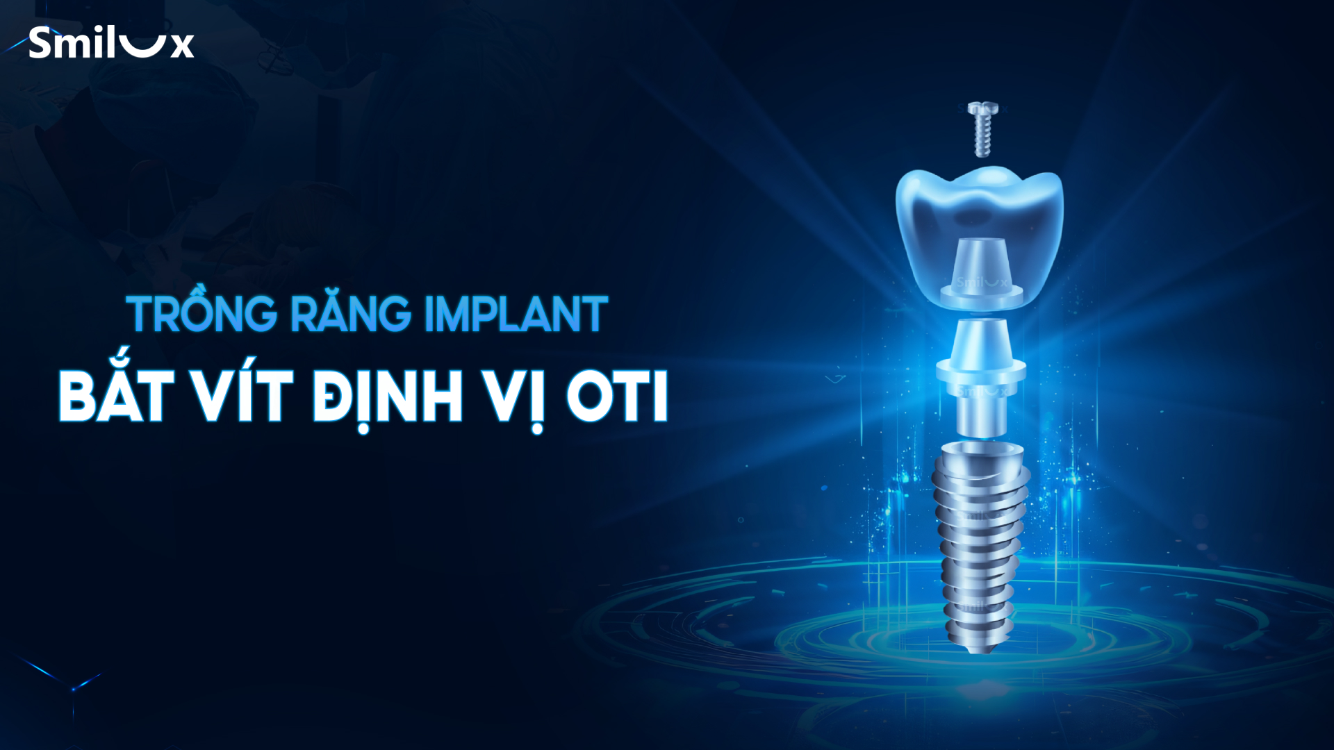 Nha khoa Smilux đột phá công nghệ trồng răng implant bắt vít định vị, không rạch lợi - 3