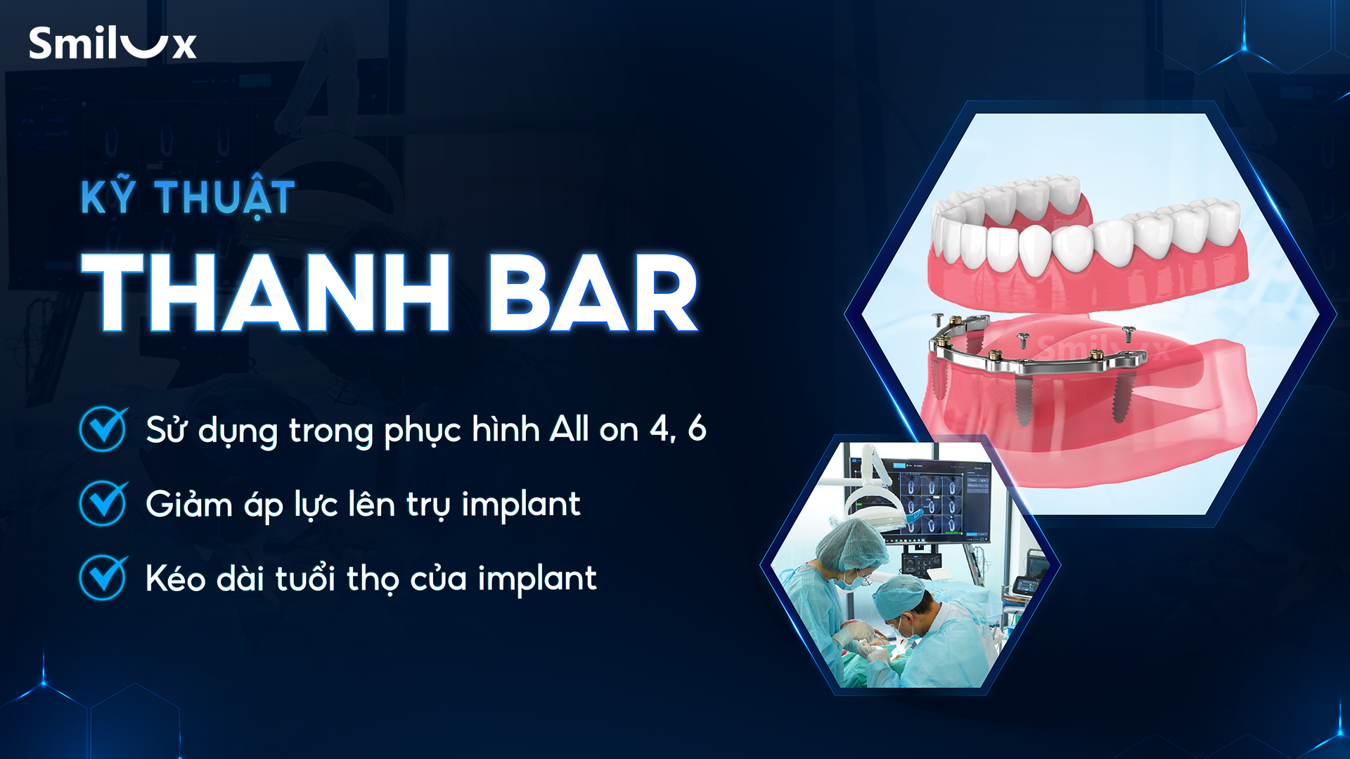 Nha khoa Smilux đột phá công nghệ trồng răng implant bắt vít định vị, không rạch lợi - 5