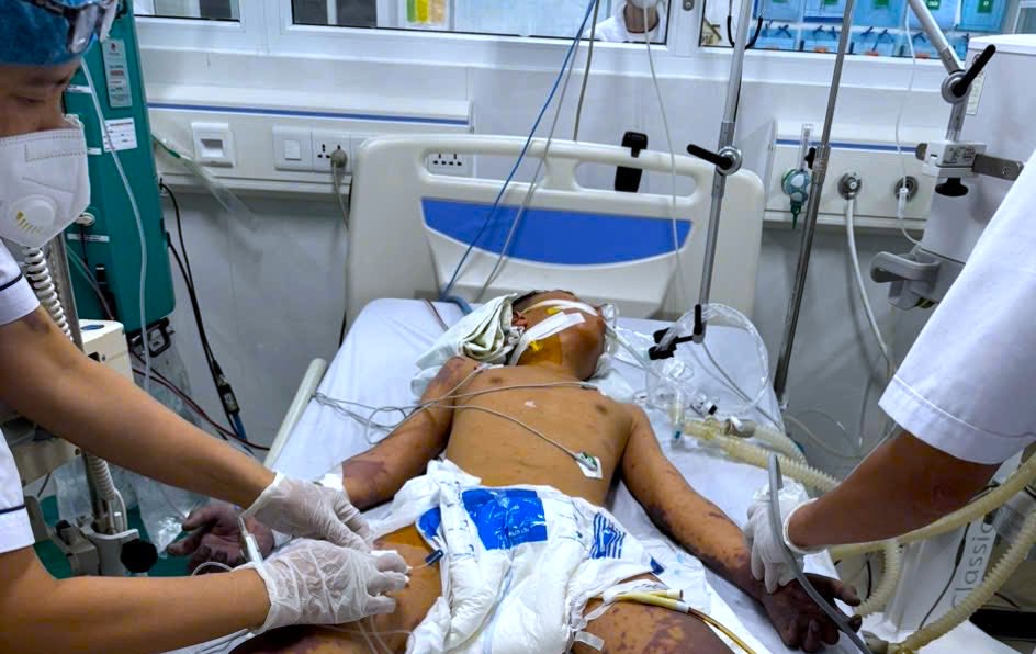 Bi kịch của cầu thủ bóng đá phải cắt bỏ chân do bệnh não mô cầu ở tuổi 17 - 3