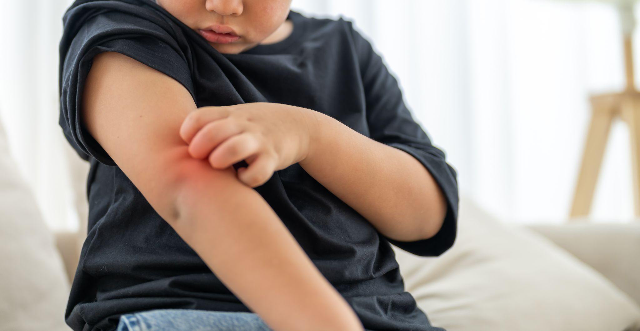 Bỏ quên mũi tiêm nhắc lại, con có thể mang di chứng suốt đời vì viêm não Nhật Bản - 1