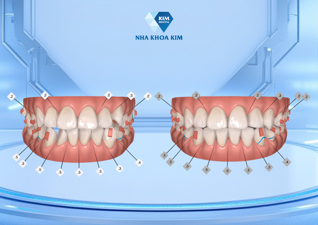 Giải mã 3 trụ cột kiến tạo nụ cười hoàn hảo tại nha khoa Top đầu TP.HCM - 2