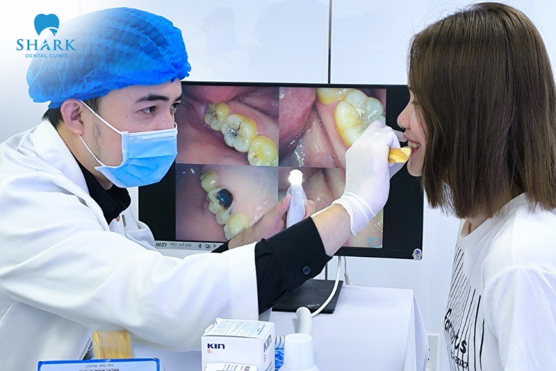 Nha khoa Shark - địa chỉ nhổ răng khôn uy tín tại Việt Nam - 2
