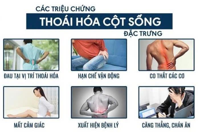 Lý do thực sự khiến nhiều người "lưng đau buốt như dao đâm" chữa mãi không cải thiện? - 2
