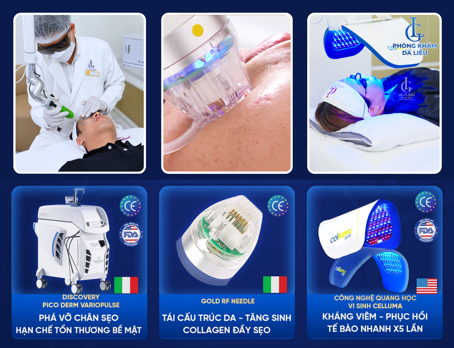 Vì sao điều trị sẹo rỗ ngày càng hướng đến phác đồ đa phương pháp? - 2