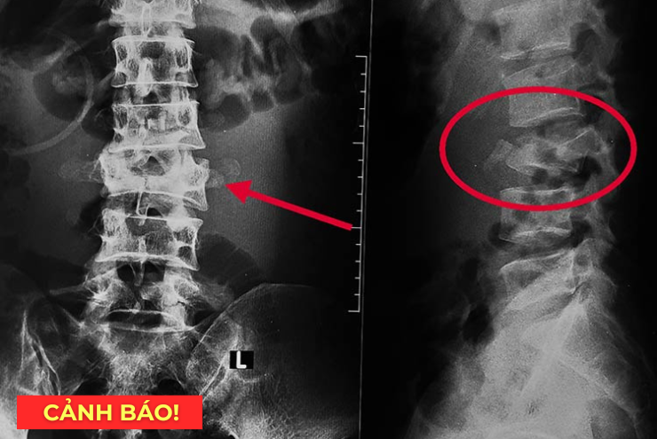 Bài viết có chỉnh sửa và gắn lại link nhãn nên chị tạo link bài mới giúp em nhé ạ - 1